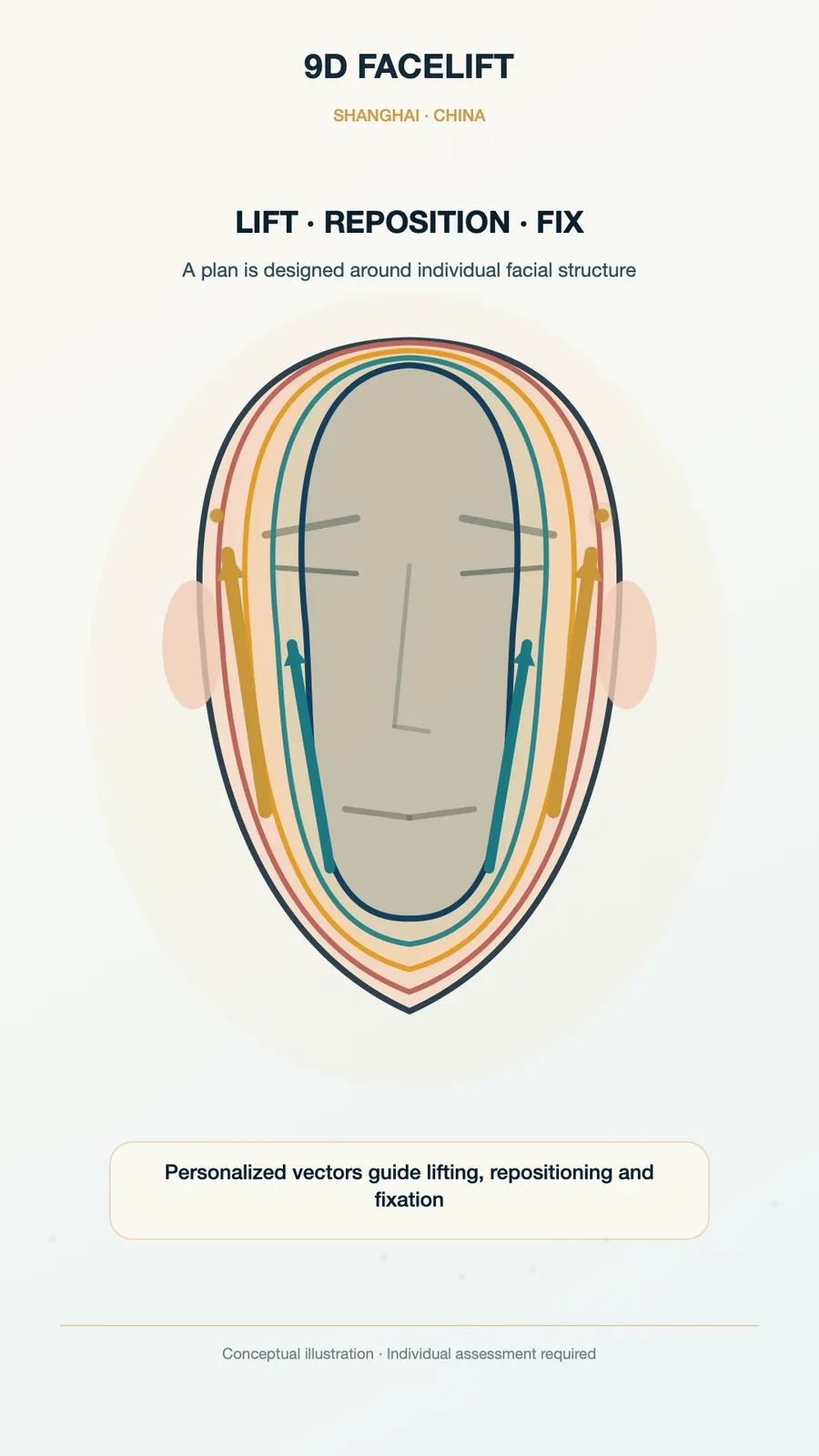 Conceptual illustration of personalized 9D lifting vectors